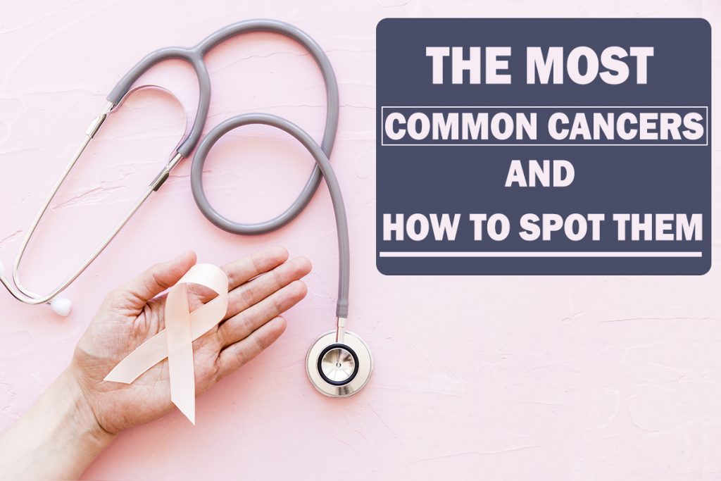 The Most Common Cancers and How to Spot Them