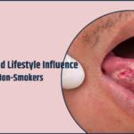 How Genetics and Lifestyle Influence Mouth Cancer in Non-Smokers?