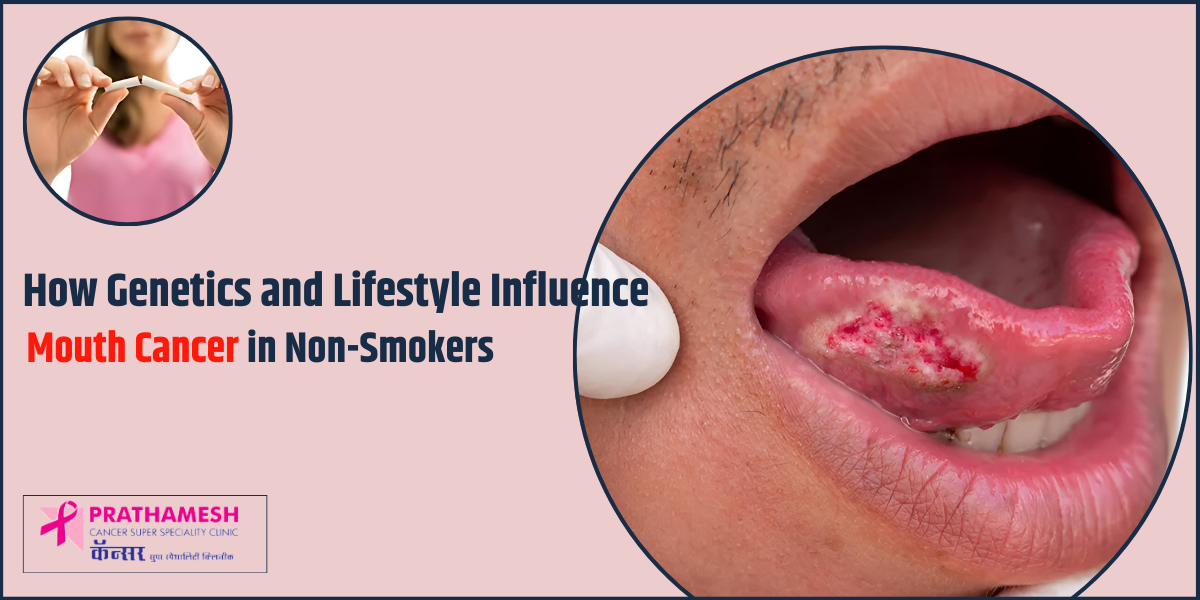 How Genetics and Lifestyle Influence Mouth Cancer in Non-Smokers?