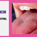 Living with Tongue Cancer: The Impact and of Treatment on Eating, Speaking, and Self-Esteem.