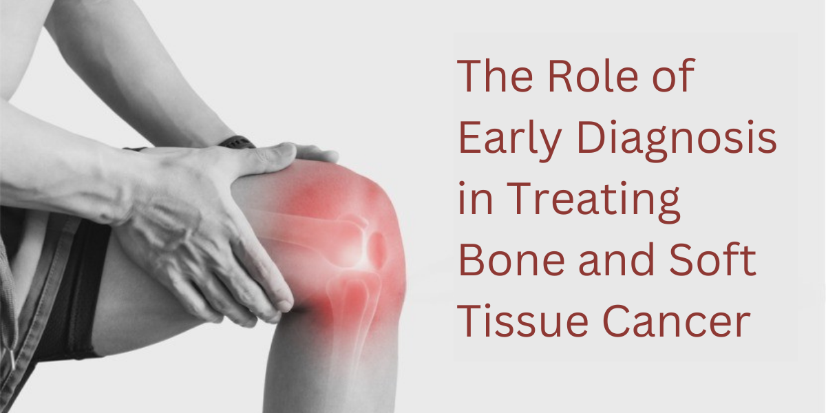 The Role of Early Diagnosis in Treating Bone and Soft Tissue Cancer