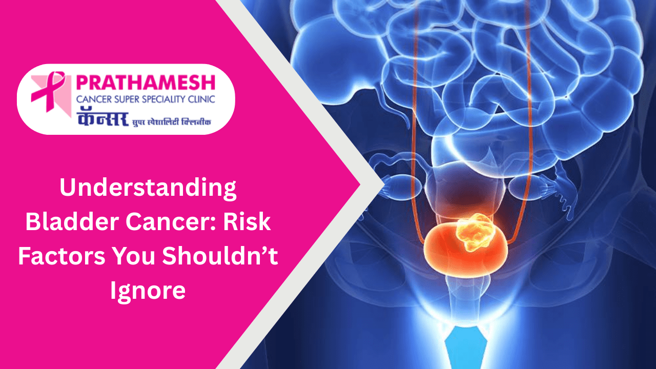 Understanding Bladder Cancer: Risk Factors You Shouldn’t Ignore