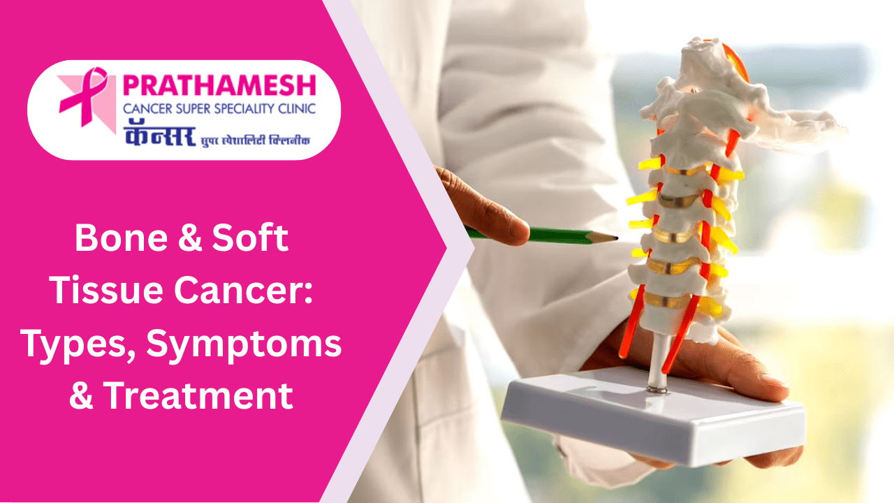 Bone & Soft Tissue Cancer: Types, Symptoms & Treatment