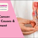 Penile Cancer Treatment in Pimpri Chinchwad (PCMC) – Dr. Ashish Pokharkar