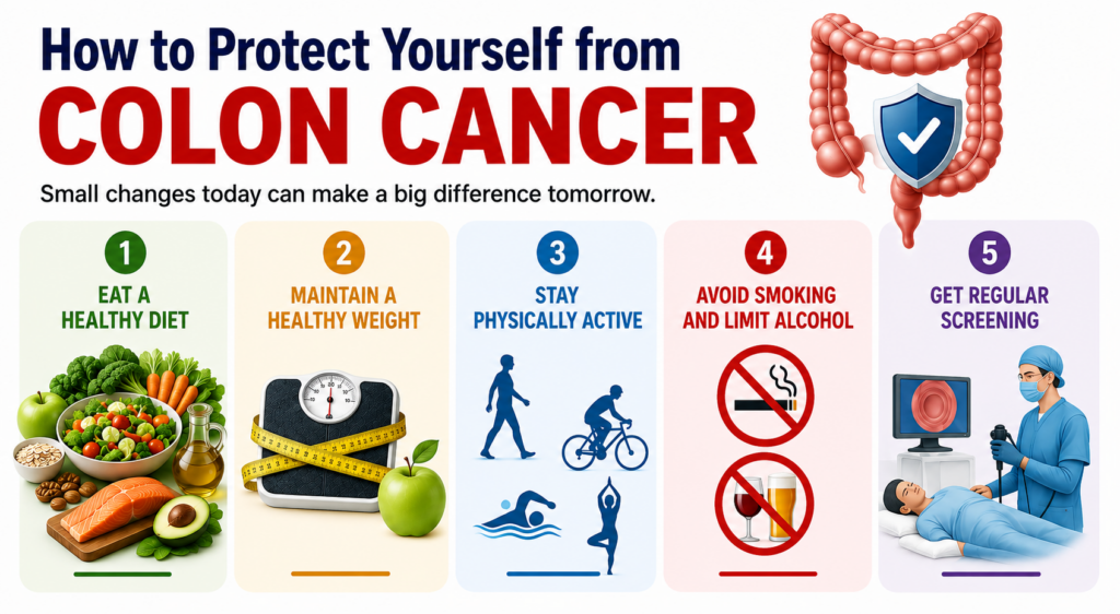 How to Protect Yourself from Colon Cancer