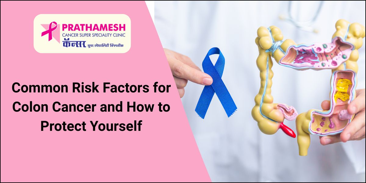 Colon Cancer