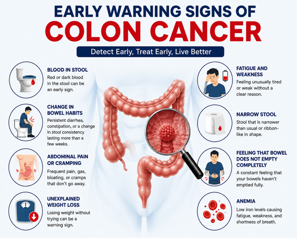 Early Warning Signs of Colon Cancer 