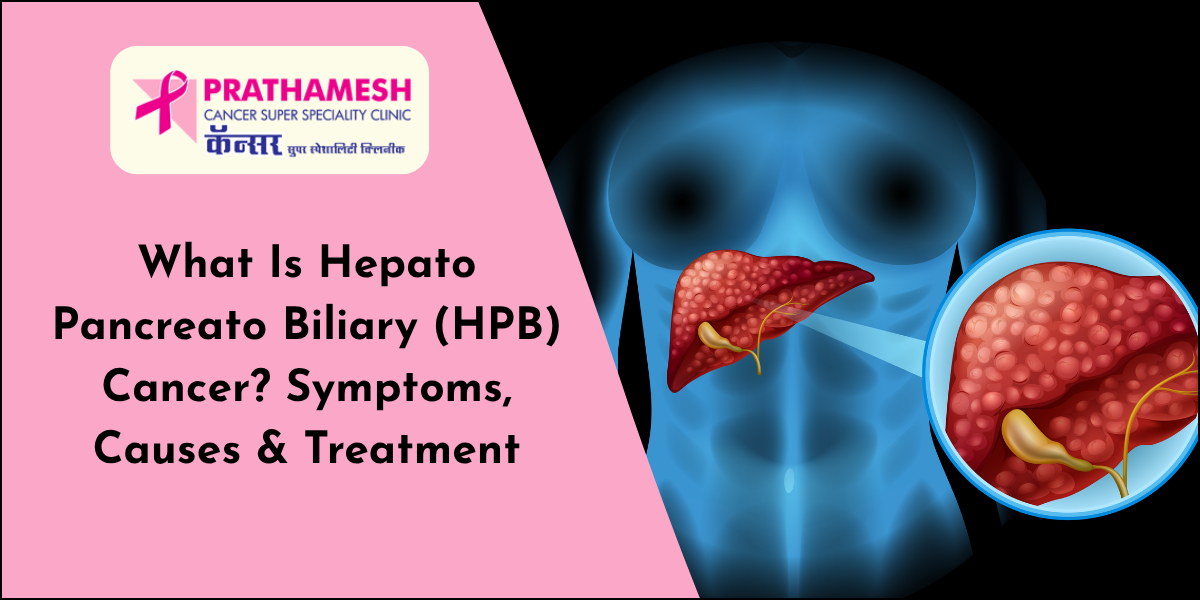 HPB Cancer: Symptoms, Causes & Treatment